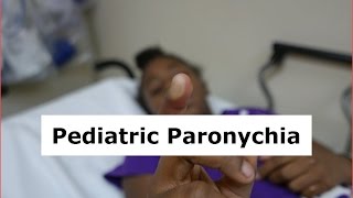 Pediatric Paronychia Drainage [upl. by Yelsgnik295]