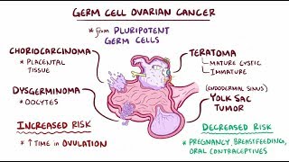 Germ cell ovarian tumors [upl. by Venn]