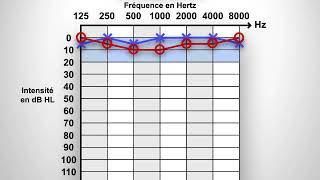 Audiogramme [upl. by Ahsad905]