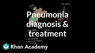 Pneumonia diagnosis and treatment  Respiratory system diseases  NCLEXRN  Khan Academy [upl. by Ecyle]