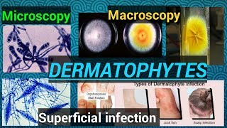 Fungal infectionFungal cultureFungal identificationDermatophytesDermatophytosisSTAR LABORATORY [upl. by Anagrom937]