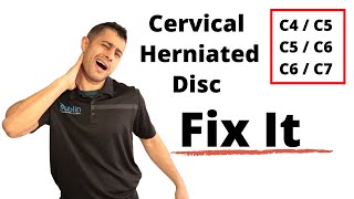 Cervical herniated disc exercises [upl. by Trub]