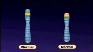 Gene Regulation Tumour Suppressor Genes  Alevel Biology  OCR AQA Edexcel [upl. by Gaige]