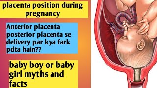 Placenta Previa होने के लक्षण इलाज और Low Lying Placenta से कैसे बचे [upl. by Boser]