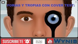 Cover Test con Forias y Tropias  Caso Real  Tests Visuales [upl. by Whiting]