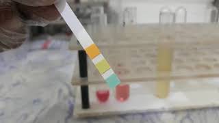 Urine Albumin Test [upl. by Lora68]