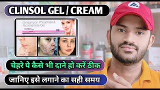 Clinsol gel how to use full review in hindi [upl. by Nev9]