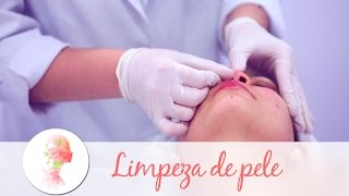 Limpeza de pele tratamento estético elimina cravos e milium [upl. by Atiana]