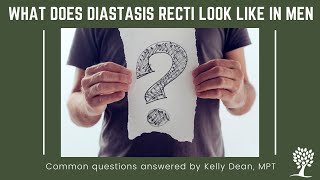 What Diastasis Recti Looks Like in Men [upl. by Anaujik992]