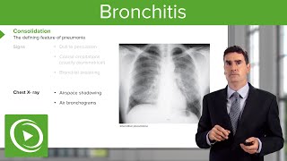 Pneumonia Introduction amp Types – Respiratory Medicine  Lecturio [upl. by Kcinemod]