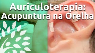 AURICULOTERAPIA BENEFÍCIOS  Acupuntura na Orelha [upl. by Anrat]