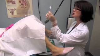 Gynecologist Common Procedures Explained [upl. by Harrell]