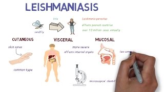 What is Leishmaniasis An introduction and overview [upl. by Hale]