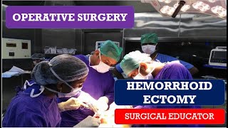 HEMORRHOIDECTOMYSTEP BY STEP OPERATIVE SURGERY [upl. by Maximilien]