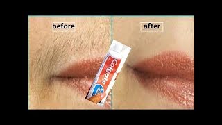 In 5 Minutes Remove Unwanted Hair  Effective Hair Removal [upl. by Thaxter]