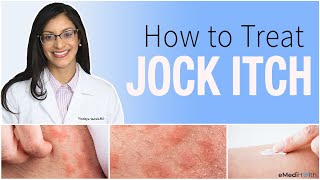 Jock Itch Treatment Prevention Causes and Home Care Tips [upl. by Edijabab49]