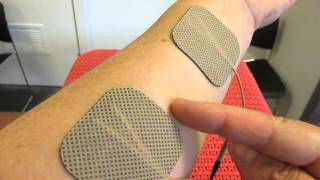 TENS  Where to apply the electrodes on forearm as example [upl. by Amero]