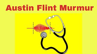 Austin Flint Murmur in Aortic Regurgitation [upl. by Agrippina]