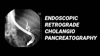 ERCP vs MRCP [upl. by Dviad732]