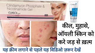 Clinsol Gel Cream  पिम्पल को करे जड़ से ख़त्म [upl. by Nedloh]