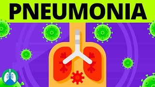 Pneumonia Overview  Causes Symptoms Diagnosis and Treatment [upl. by Johst]