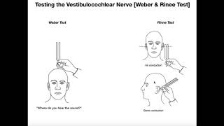 Interpreting the WeberRinne Tests EXPLAINED [upl. by Caldera]