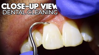 Dental Cleaning  CloseUp View ASMR [upl. by Lemal]