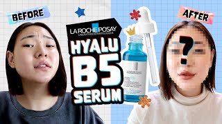 Honest Review 14 days WITH LA ROCHEPOSAY Hyalu B5 Hyaluronic Acid Serum [upl. by Htebaras448]