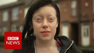 How I overcame stigma of albinism  BBC News [upl. by Fink]