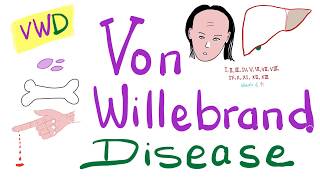 Gaucher disease  causes symptoms diagnosis treatment pathology [upl. by Brandais]