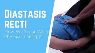 How We Treat Diastasis Recti  Physical Therapy [upl. by Amuwkuhc291]