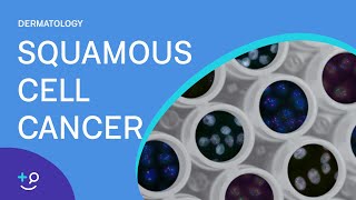 Squamous Cell Cancer Dermatology [upl. by Chard]