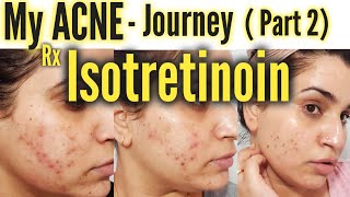 My Acne Journey Part 2  Isotretinoin [upl. by Kaule]