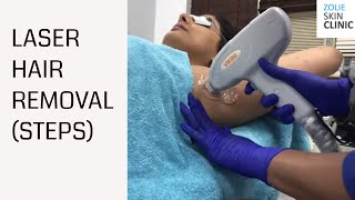 Underarm Hair Removal Laser TreatmentFast  Laser Hair Removal in Delhi and Gurgaon [upl. by Eednarb]