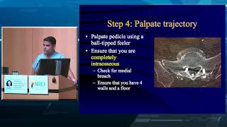 Lumbar Pedicle Screw Placement [upl. by Nate398]