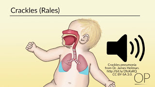 Respiratory Assessment by B Leary L DelSignore  OPENPediatrics [upl. by Marianna]