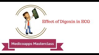 Understanding the Effects on Digoxin on ECG [upl. by Yirinec164]