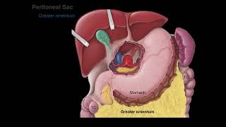 Peritoneum tutorial [upl. by Amre]