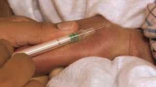 Newborn Care Series Giving an Intradermal Injection [upl. by Klingel]