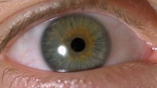 My Iris Wobbles  Eye In Slow Motion [upl. by Salem]