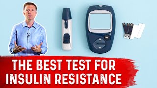 HOMAIR – The Best Insulin Resistance Test – Dr Berg [upl. by Aikyn388]