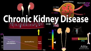 Chronic Kidney Disease Animation [upl. by Latreese747]