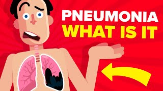 Pneumonia  Explained [upl. by Sargent634]