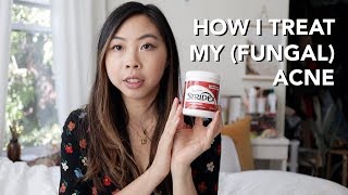 HOW I TREAT MY ACNE amp FUNGAL ACNE [upl. by Bruis]