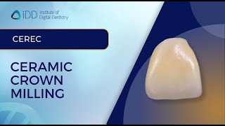 Ceramic Crown Milling using CEREC  iDD [upl. by Bellamy]