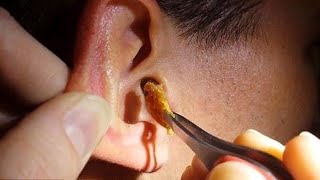 Technique japonaise pour déboucher les oreilles 3 ASMR [upl. by Wiles]