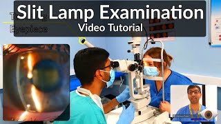 Slit Lamp Exam Tutorial  Part 1 [upl. by Ahsilad52]