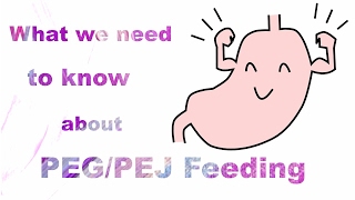 What we need to know about PEGPEJ feeding [upl. by Oak834]