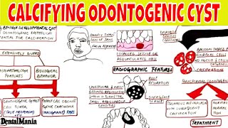 Giant cell tumor of Bone Osteoclastoma  Pathology [upl. by Notyal132]