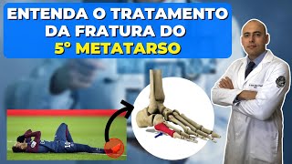 FRATUROU O QUINTO METATARSO SAIBA O TRATAMENTO [upl. by Limaj]